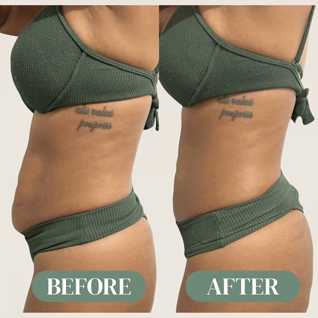 INFLOW® — Advanced Lymphatic & Fluid Balance Support